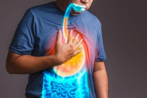 Reflusso Gastroesofageo che Risale fino alla Gola in un Uomo di Mezza Età