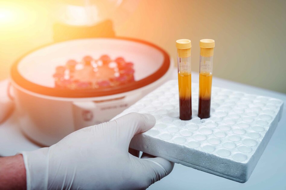 Plasma iperimmune: cura per il Covid-19