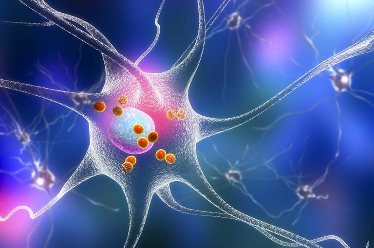 Parkinson e nevrosi Parkinson e nevrosi: il Legame