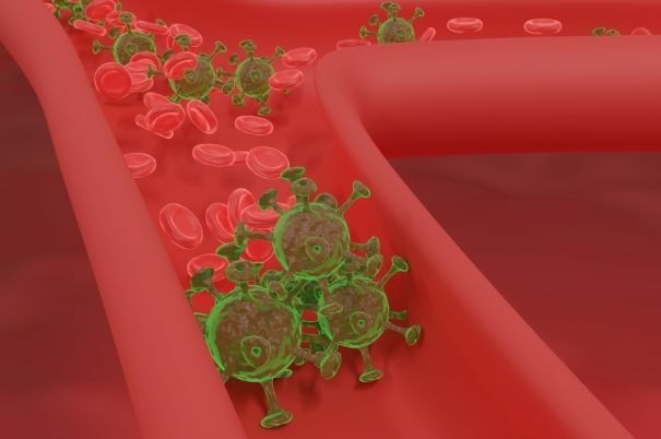 Infezione Virale da Covid-19 nel Flusso Sanguigno 