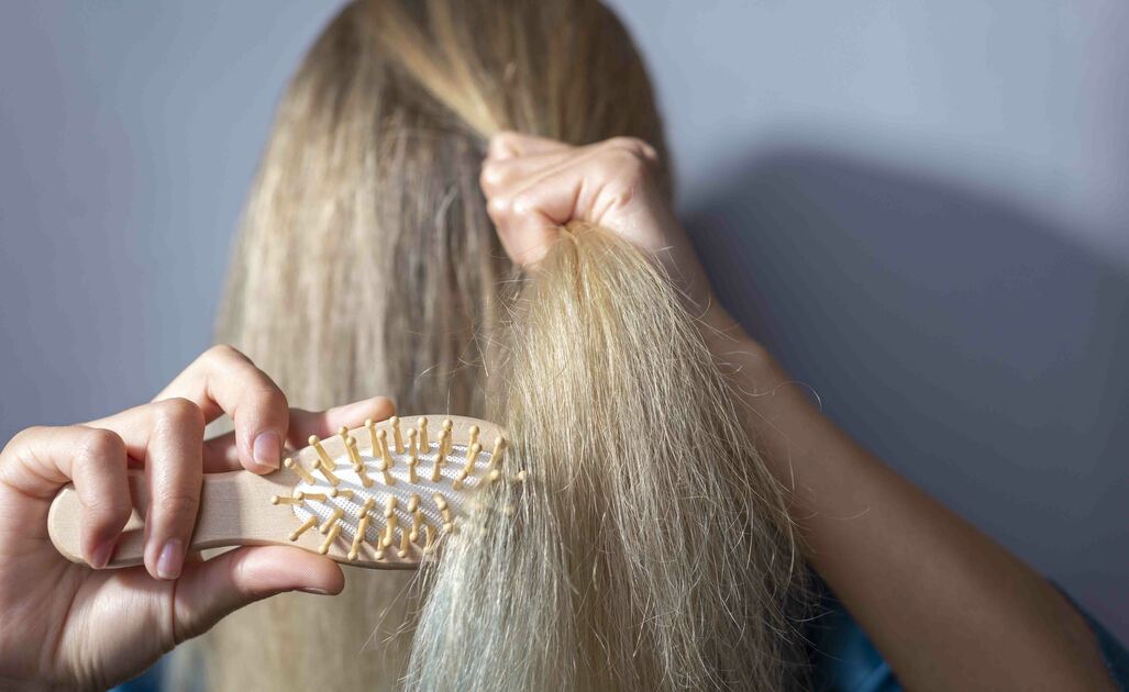 Capelli Fragili: Quali Integratori Scegliere