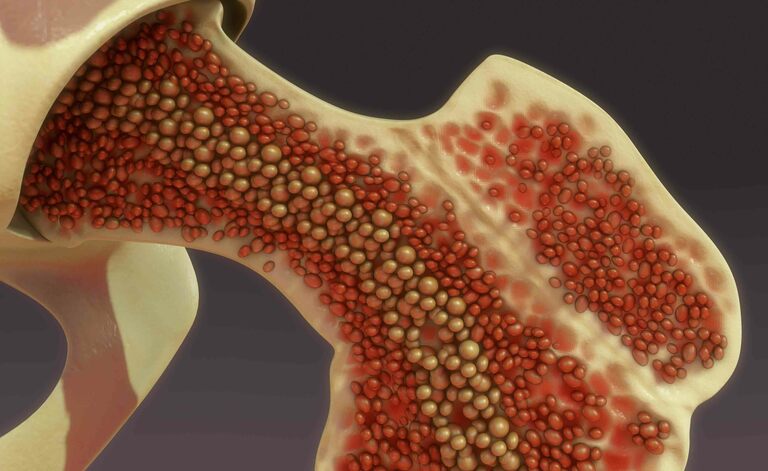 Salute delle Ossa: il Calcio