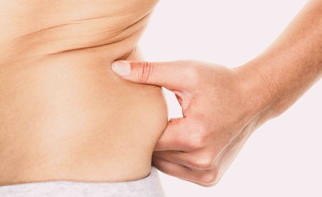 Maniglie dell'Amore: Come Eliminarle