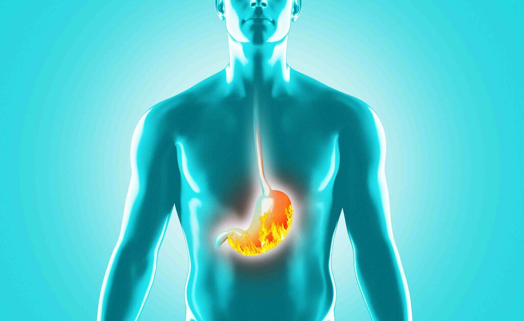 Effetti Gastroprotettori