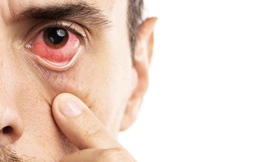 Congiuntivite da Mascherina: Rimedi