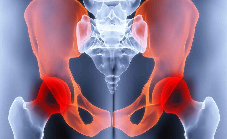 Dolore Inguine: le Cause