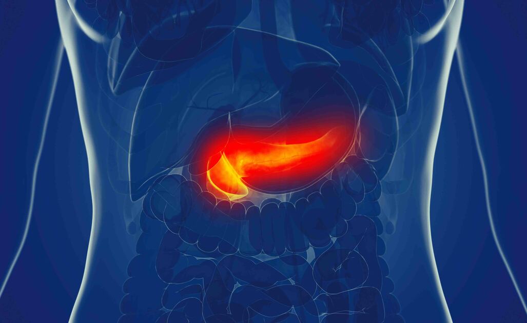 Pancreatite e Diabete
