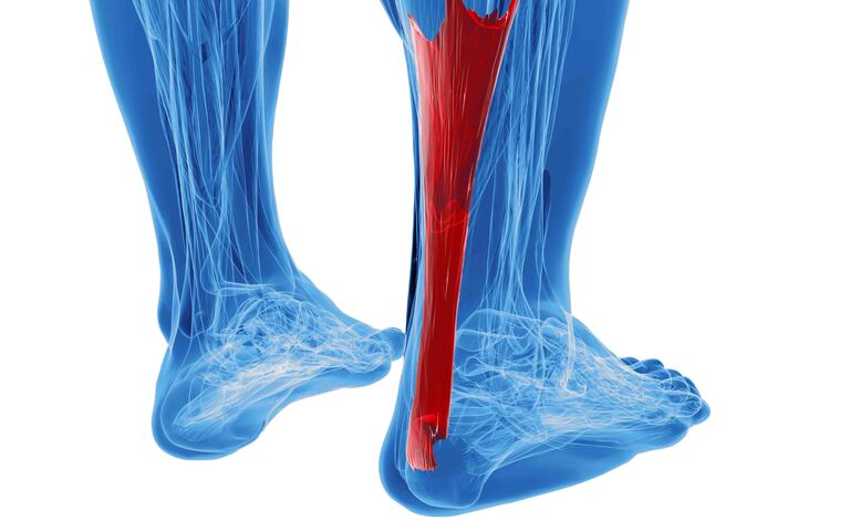 Tendine d'Achille: Infiammazione