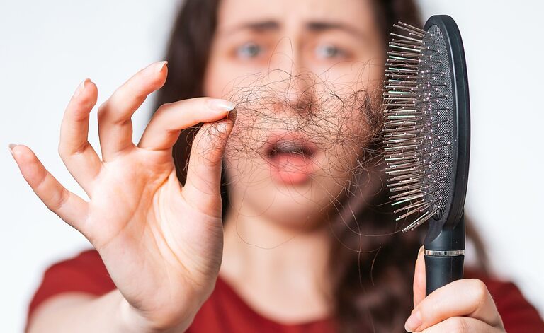 L'Alopecia Areata Può Essere Sintomo Di Ictus?