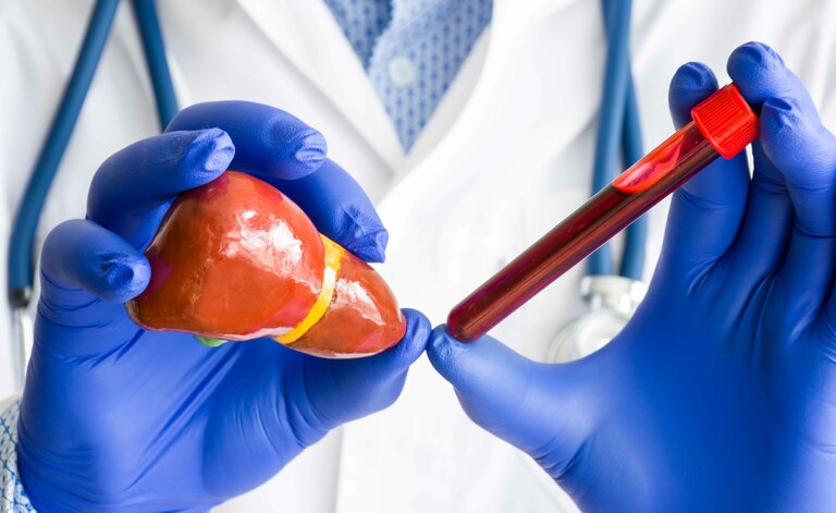 Tutte Le Cause Delle Transaminasi Alte