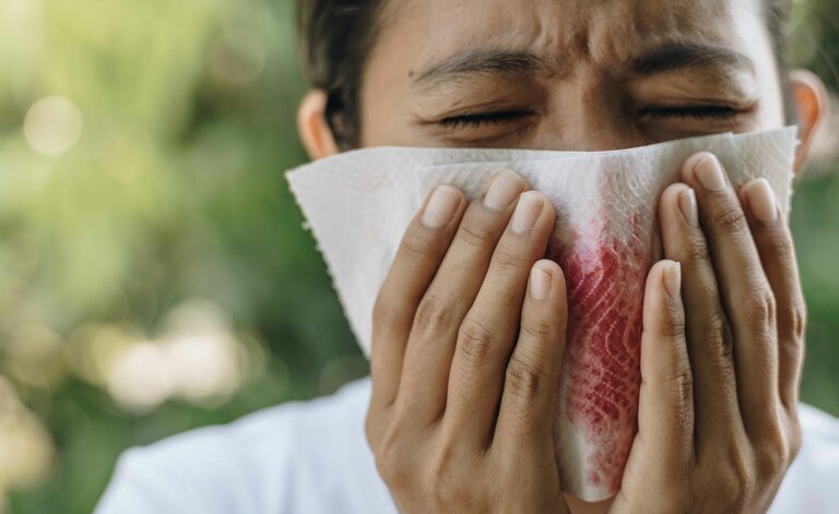 Scopriamo Tutte Le Cause Del Sangue Dalla Bocca