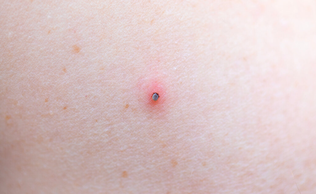 Zecche: Come Riconoscerle?