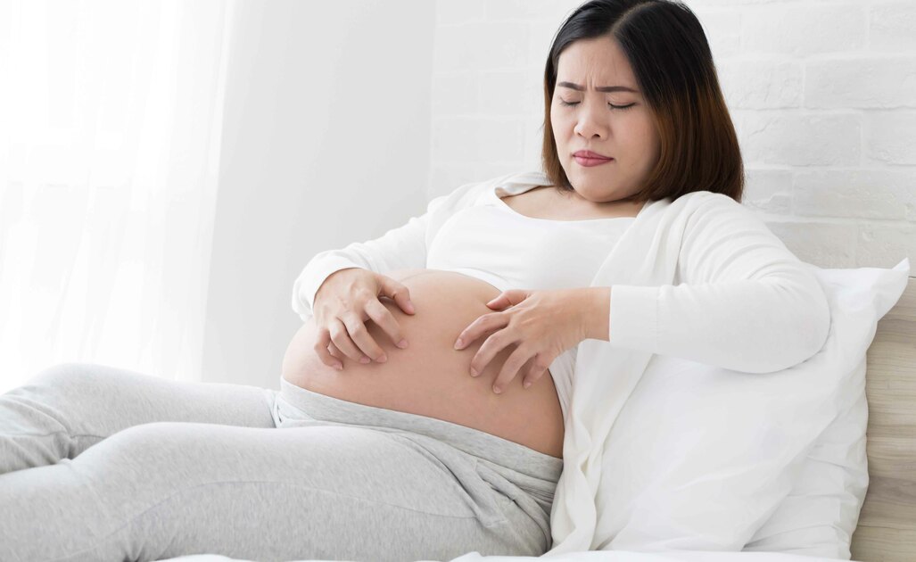 Le Cause Del Prurito In Gravidanza