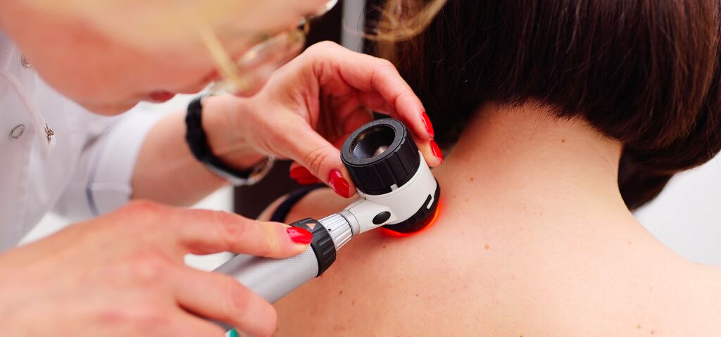 Nei Rossi: Di Cosa Si Tratta?