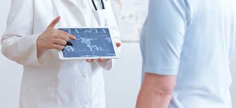 Aneurisma Cerebrale: Cosa Sapere?