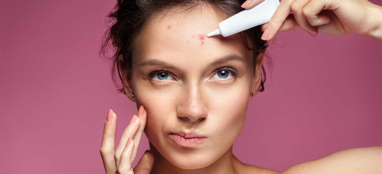 Il dentifricio sui brufoli fa male?