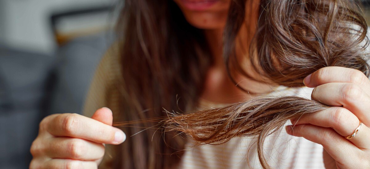 Caduta dei capelli: cause e rimedi