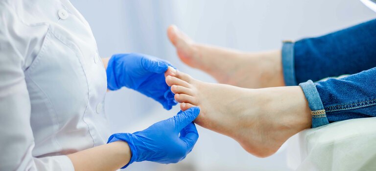 Scopriamo quali sono i motivi per cui un'unghia si ingiallisce