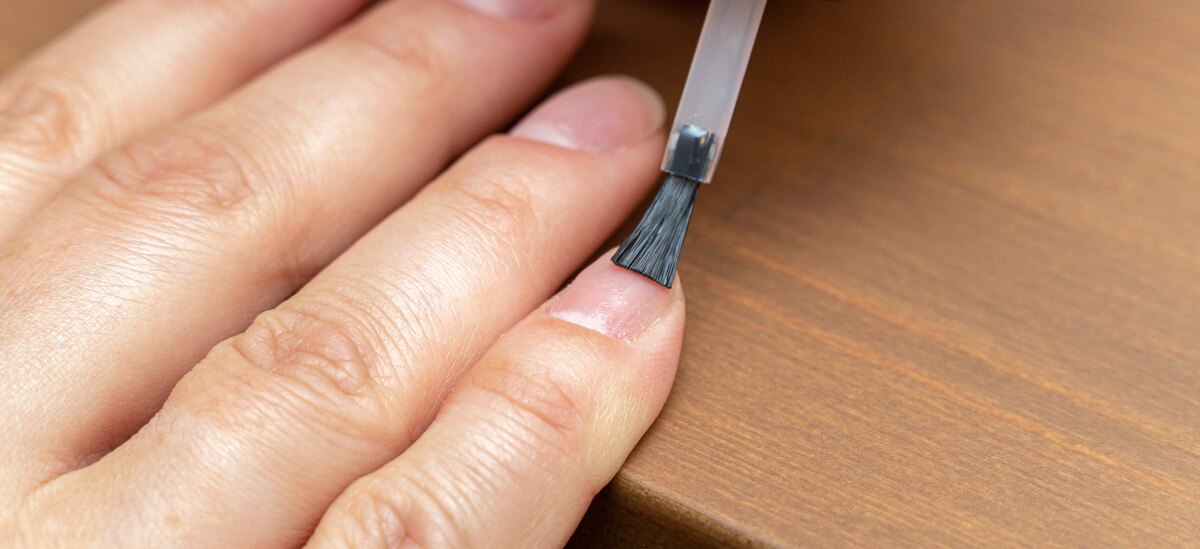 Cause psoriasi ungueale