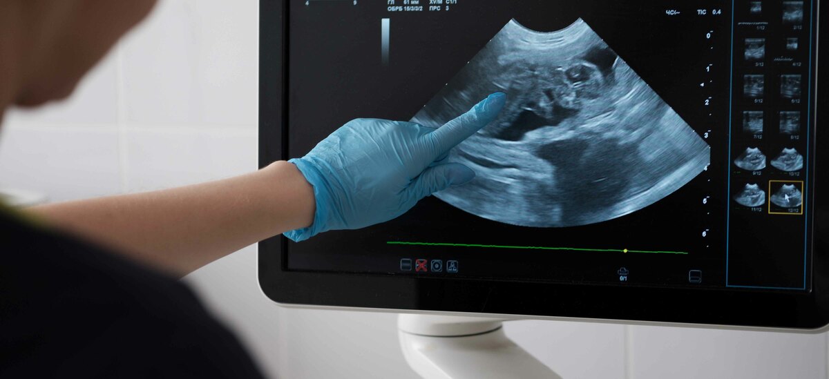 23 esima settimana di gravidanza