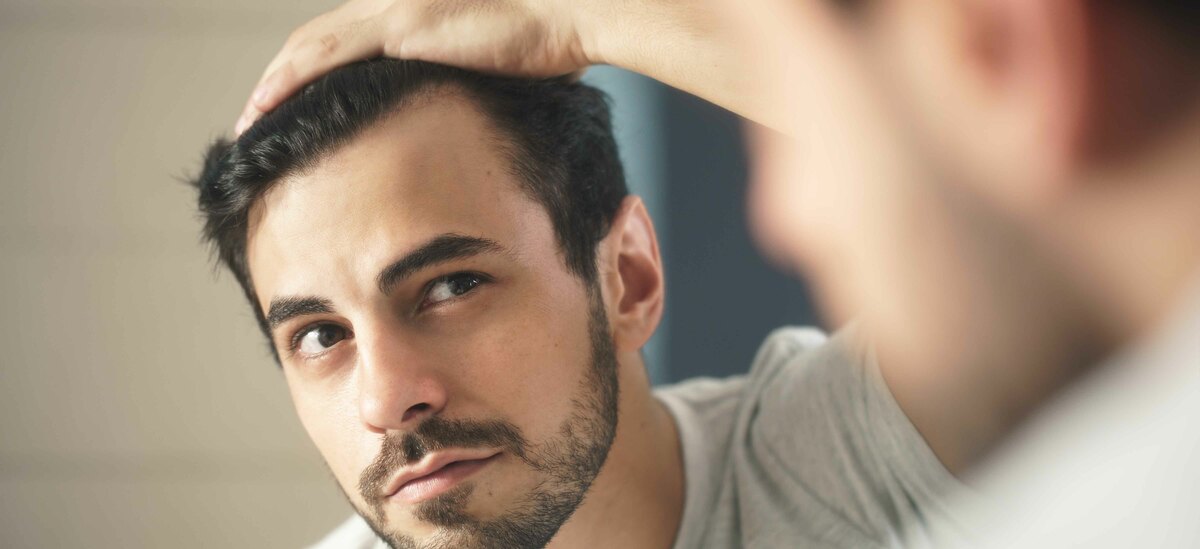 Scopriamo in cosa consiste l'alopecia androgenetica