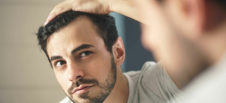 Scopriamo in cosa consiste l'alopecia androgenetica