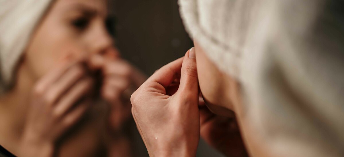 Scopriamo gli effetti del retinolo contro l'acne