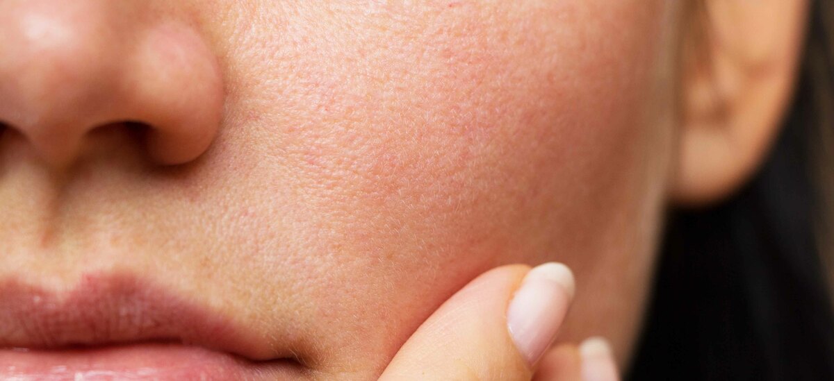 Stress ossidativo per effetto dell'inquinamento