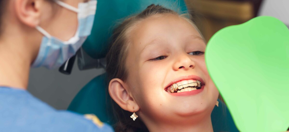 Apparecchio denti costo