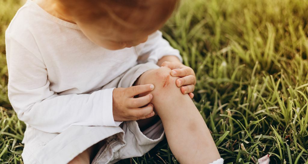 bambina con ginocchio sbucciato