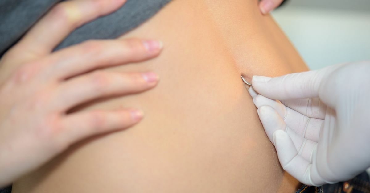 Infezione del piercing all'ombelico: come si tratta?