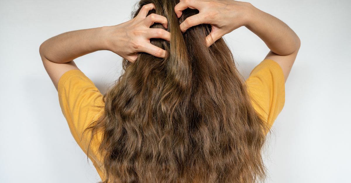 Desquamazione del cuoio capelluto: le cause