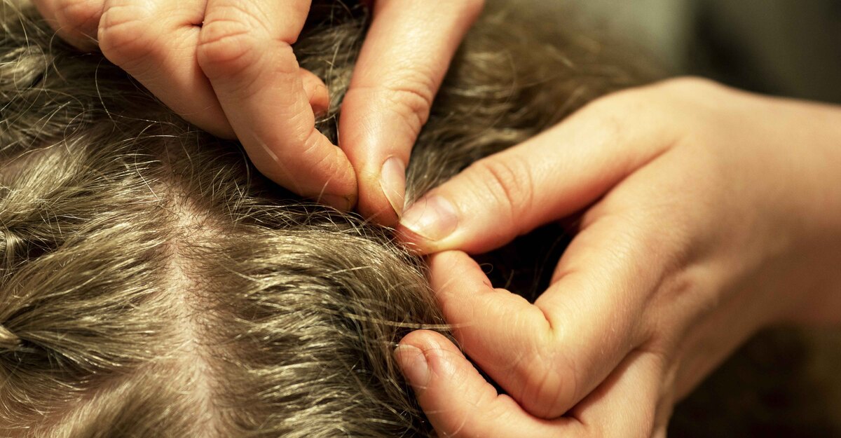Bambina viene controllata da un medico tra i capelli