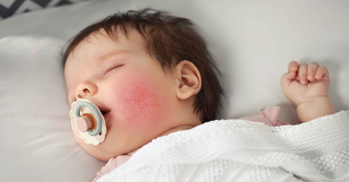 Un neonato con le guance rosse