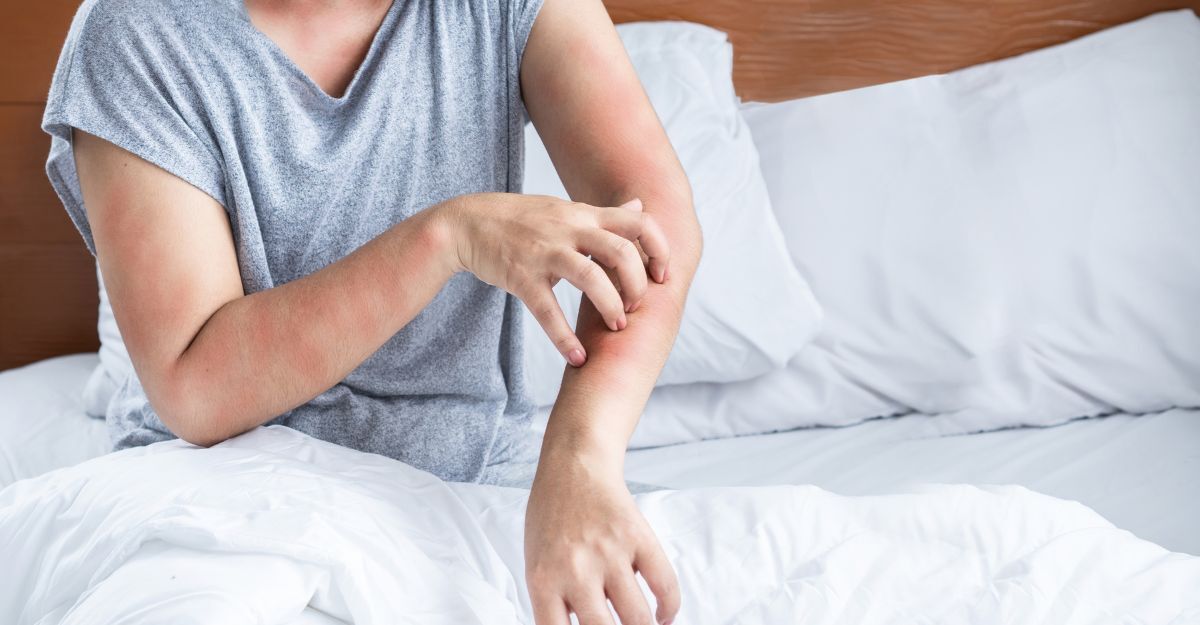 ragazza si gratta un braccio