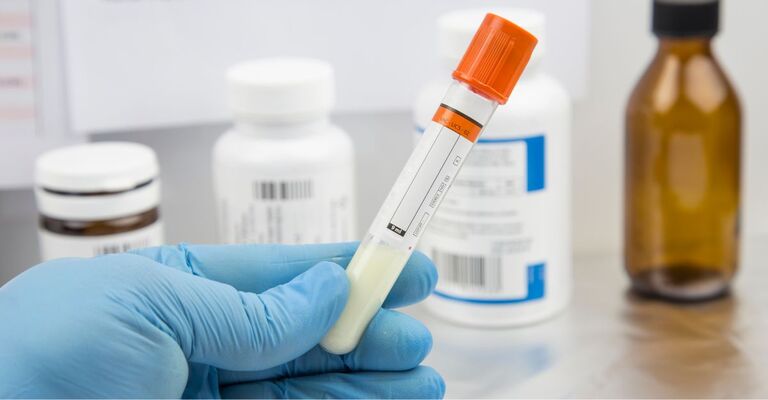 Provetta con campione la suo interno