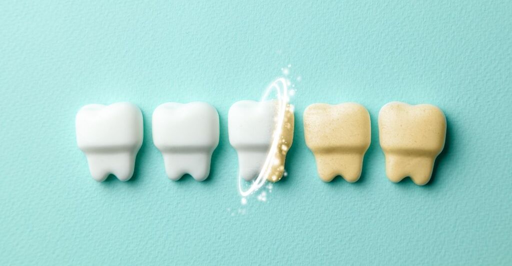 denti-con-macchie-bianchi