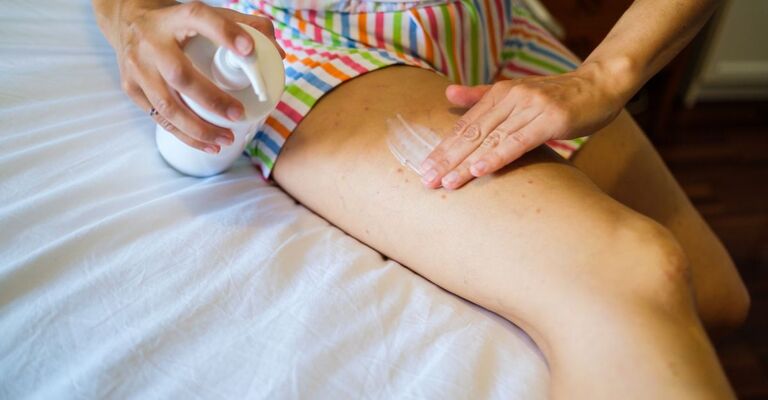 Donna spalma crema sulla coscia seduta sul letto