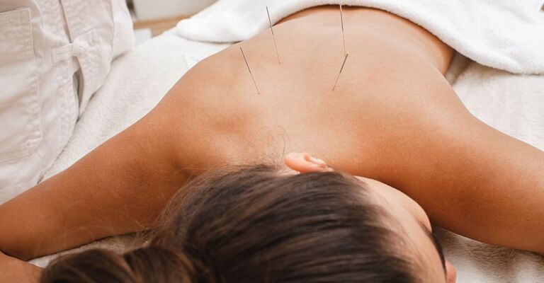 ragazza fa agopuntura