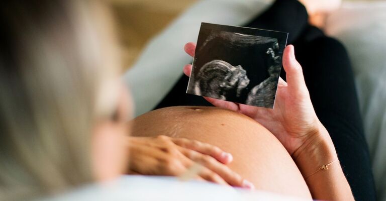 Donna incinta con ecografia sulla pancia