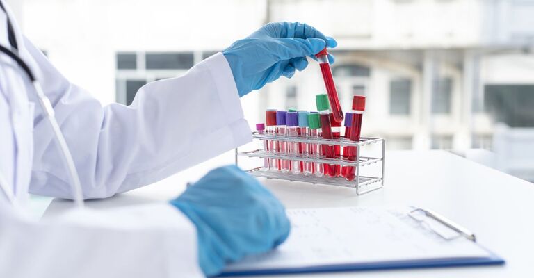 Delle provette con dentro del sangue