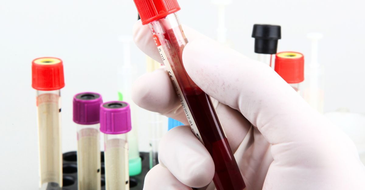 Un medico con delle fiale di sangue