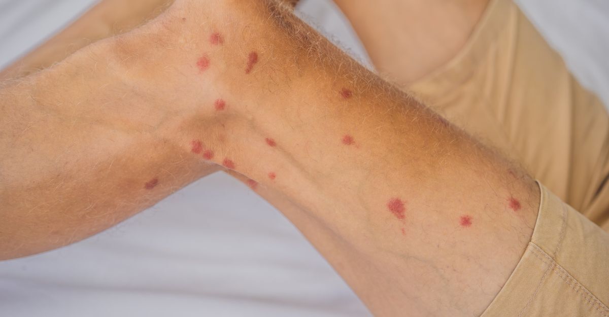 Delle gambe con dei puntini rossi