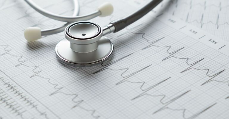 Uno stetoscopio appoggiato su un elettrocardiogramma