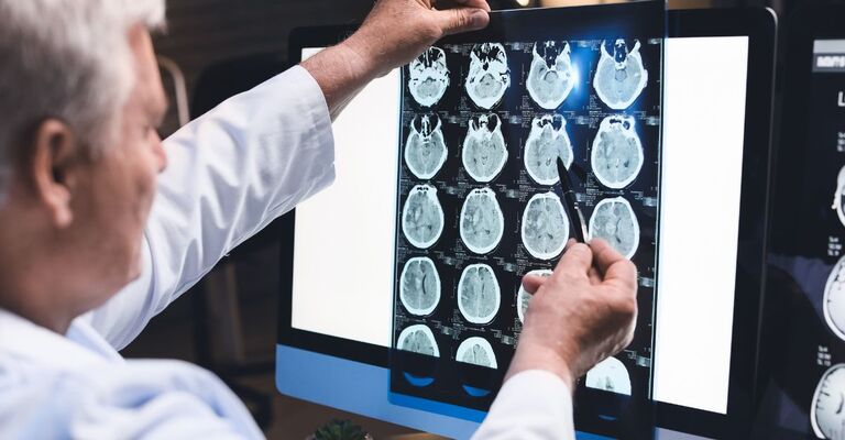 Un medico osserva una lastra di un cervello