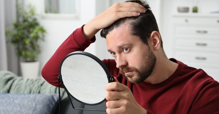 Uomo che osserva i suoi capelli radi allo specchio