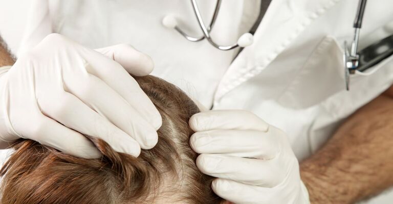Un dermatologo osserva da vicino il cuoio capelluto di una paziente