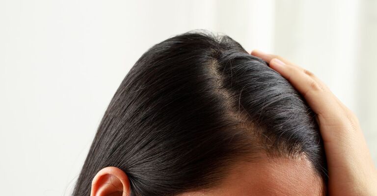 Una donna si tocca il cuoio capelluto
