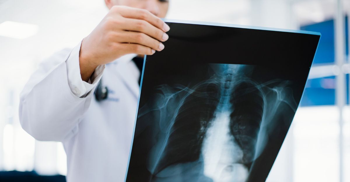 Un medico tiene in mano una radiografia ai polmoni 