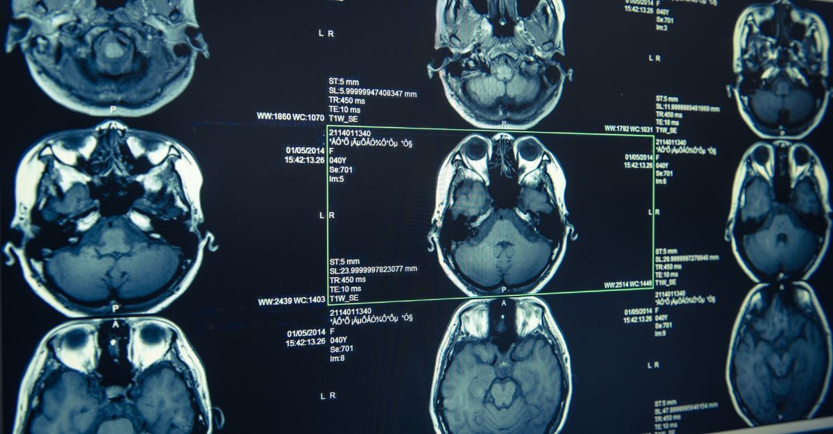 L'ecografia di un cranio
